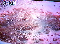 ブルーベリージャム。